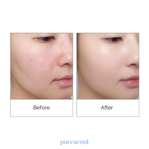 Athe Glazm Watering Cushion SPF50+ PA+++ - 2 Shades (14g)